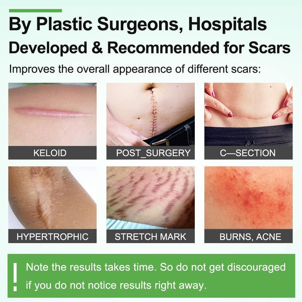 Scarlix Tape by Marketfuse – Fast & Painless Scar Removal Solution At Home