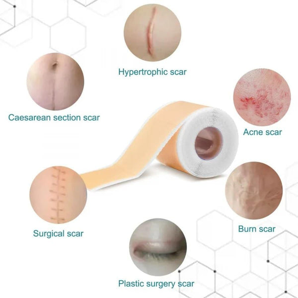 Scarlix Tape by Marketfuse – Fast & Painless Scar Removal Solution At Home