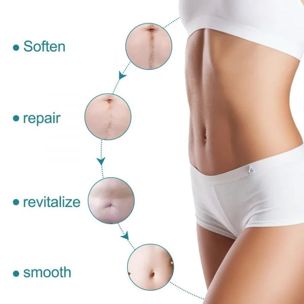 Scarlix Tape by Marketfuse – Fast & Painless Scar Removal Solution At Home