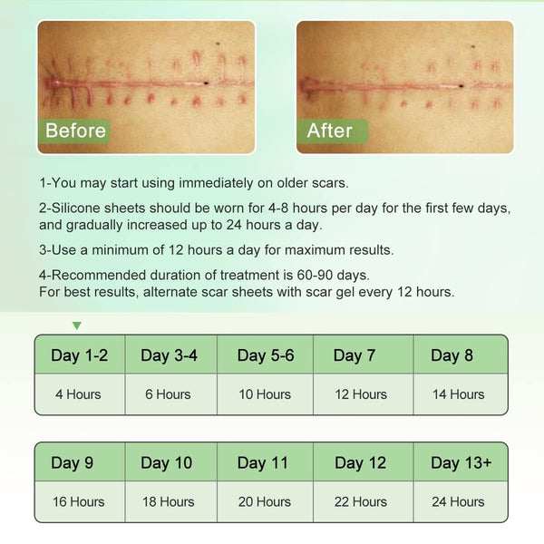 Scarlix Tape by Marketfuse – Fast & Painless Scar Removal Solution At Home