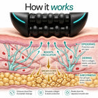 Mfuse™ TheraPulse