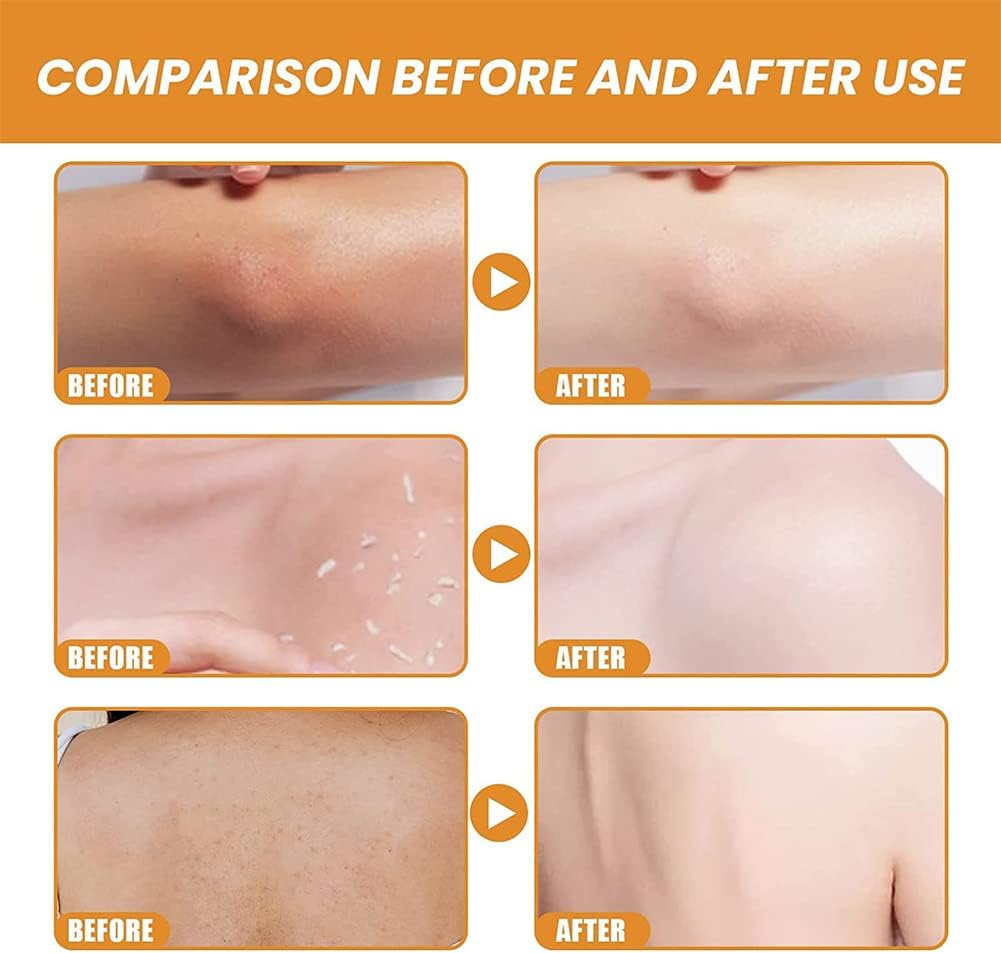 CitrusPulse™ Exfoliating Gel
