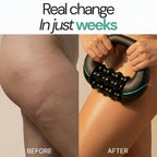 Mfuse™ TheraPulse