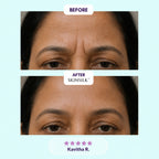 SkinSilk™ Tape