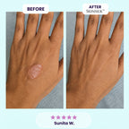 SkinSilk™ Tape